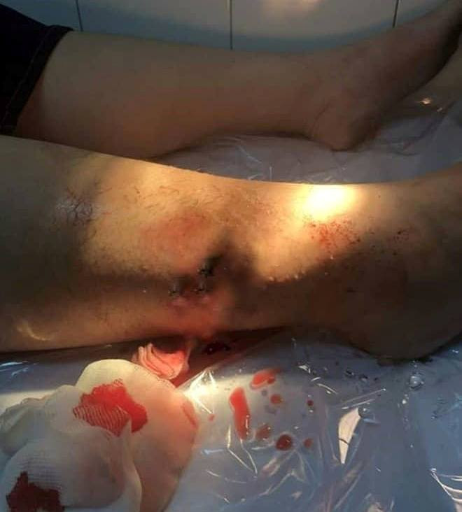 40093111_283476305809757_2471490659345760256_n