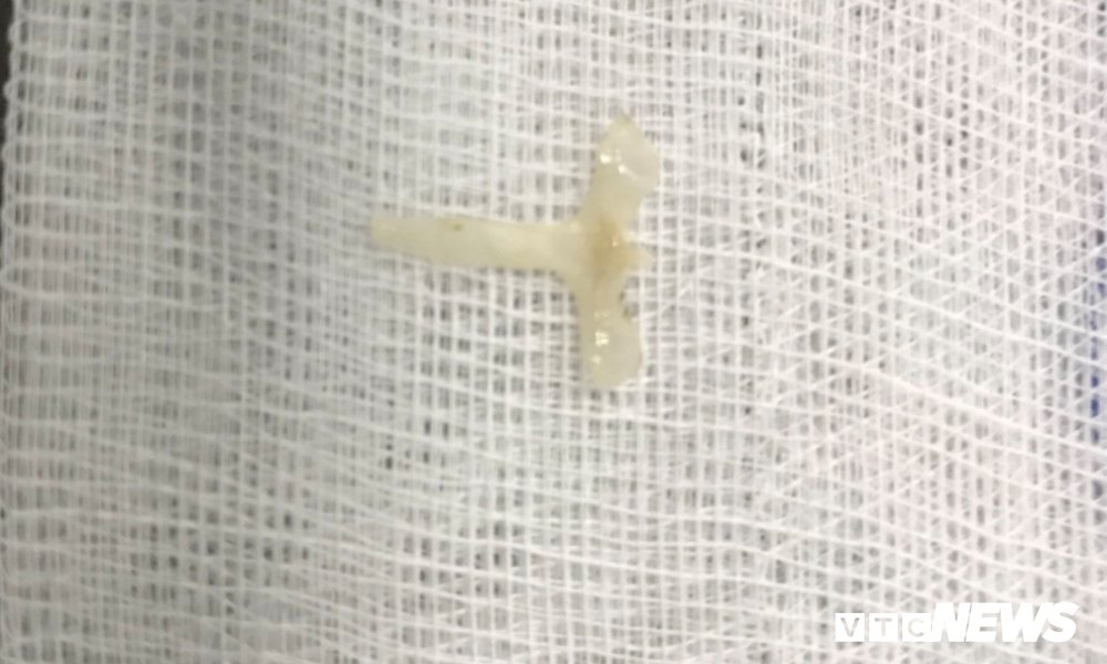 ANH 1 (1)