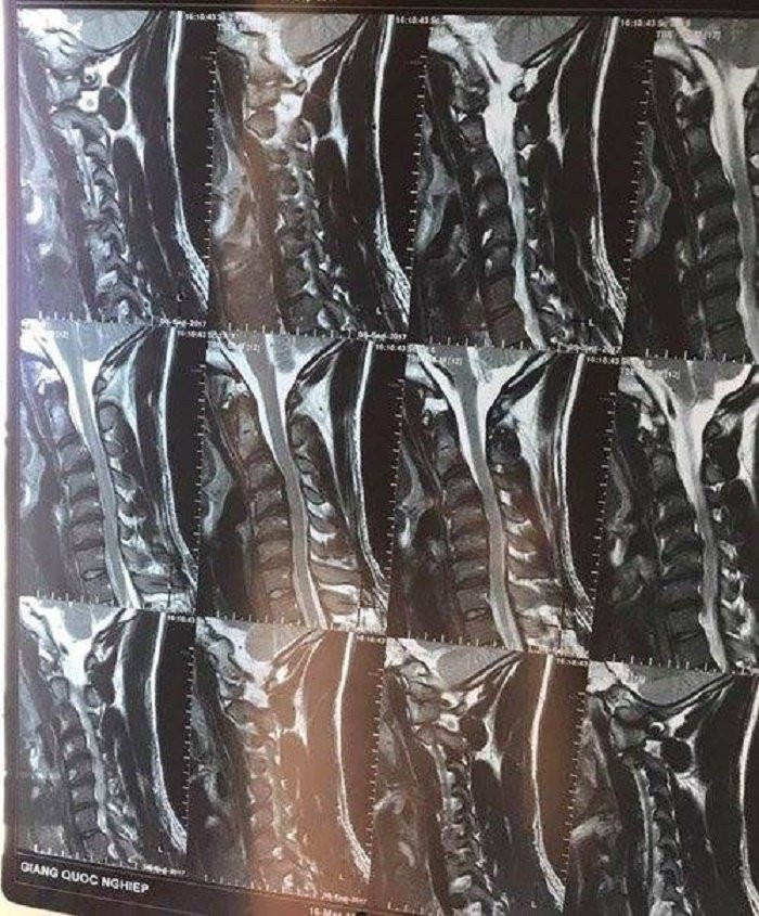 34559889102045618655620752430049026712797184n-1528345765958338039436-1318168 17