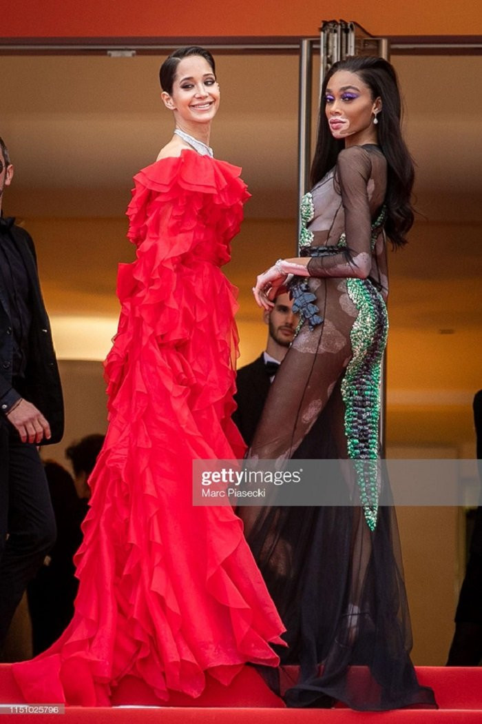 nguoimaubrazilbituotvaycannes (8) 7