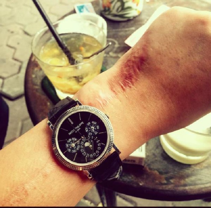 bantraidomylinh (6) 5