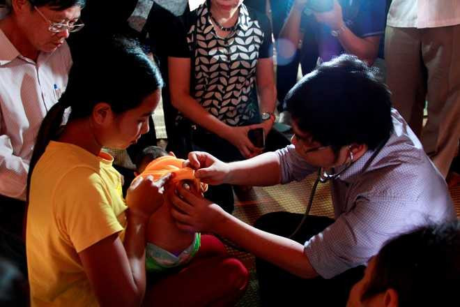 Chua khang dinh chau be bi chung dau nho do virus Zika hinh anh 1