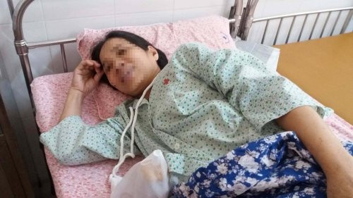 Hinh anh Mang khoi u nang buong trung 15kg, benh nhan bi nham co bau