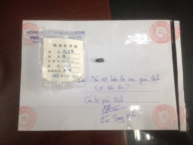 Một trong những đầu đạn công an thu giữ được tại hiện trường vụ án (ảnh Công an cung cấp)