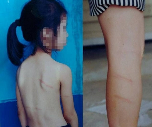 Hoc sinh lop 1 khong lam duoc bai to bi co giao danh hinh anh 1