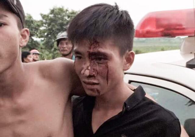 19397806_411336329263780_1974581014_n