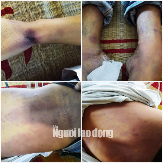 Tử vong sau khi bị công an bắt - Ảnh 1.