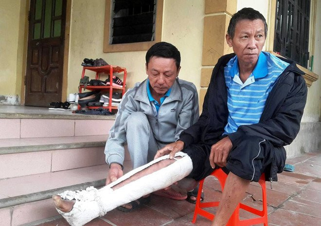 Loi khai cua nghich tu danh bo gay xuong suon hinh anh 2