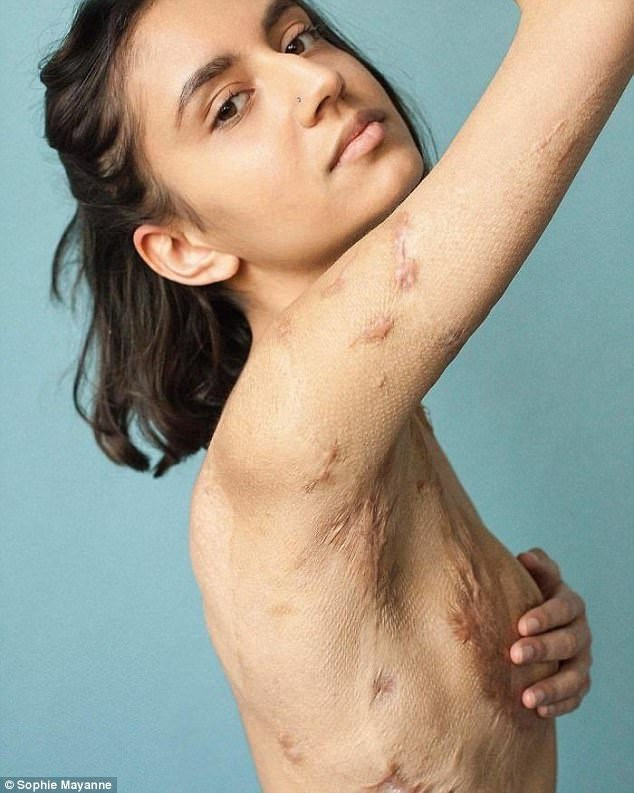 10 co gai dung cam va cau chuyen vet seo di theo ca cuoc doi hinh anh 1