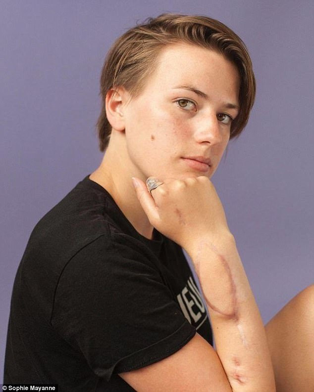 10 co gai dung cam va cau chuyen vet seo di theo ca cuoc doi hinh anh 6