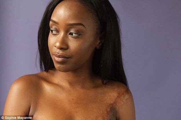 10 co gai dung cam va cau chuyen vet seo di theo ca cuoc doi hinh anh 7