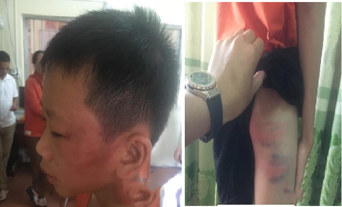 35518709_1324264287709620_4906909675078811648_n