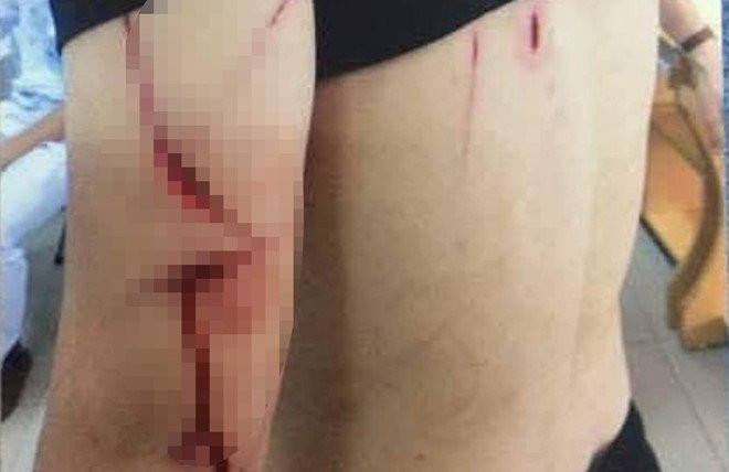 Hang chuc con do o Hai Phong chem trong thuong mot nguoi hinh anh 1