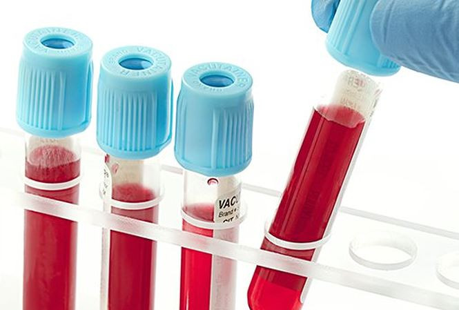 Soc-voi-ket-qua-xet-nghiem-hoa-chat-doc-hai-trong-mau-cua-nguoi-Ha-Noi-xet-nghiem1-1532664697-302-width665height449 3