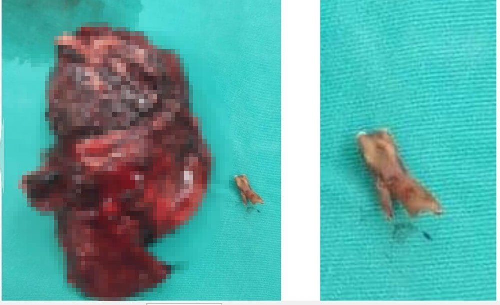 ho-ra-mau-set-danh-1828336 4