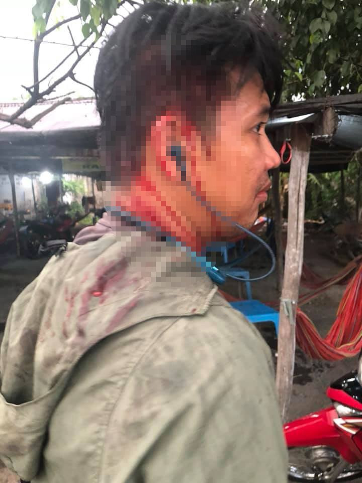 to-chat-chem-bi-danh 4