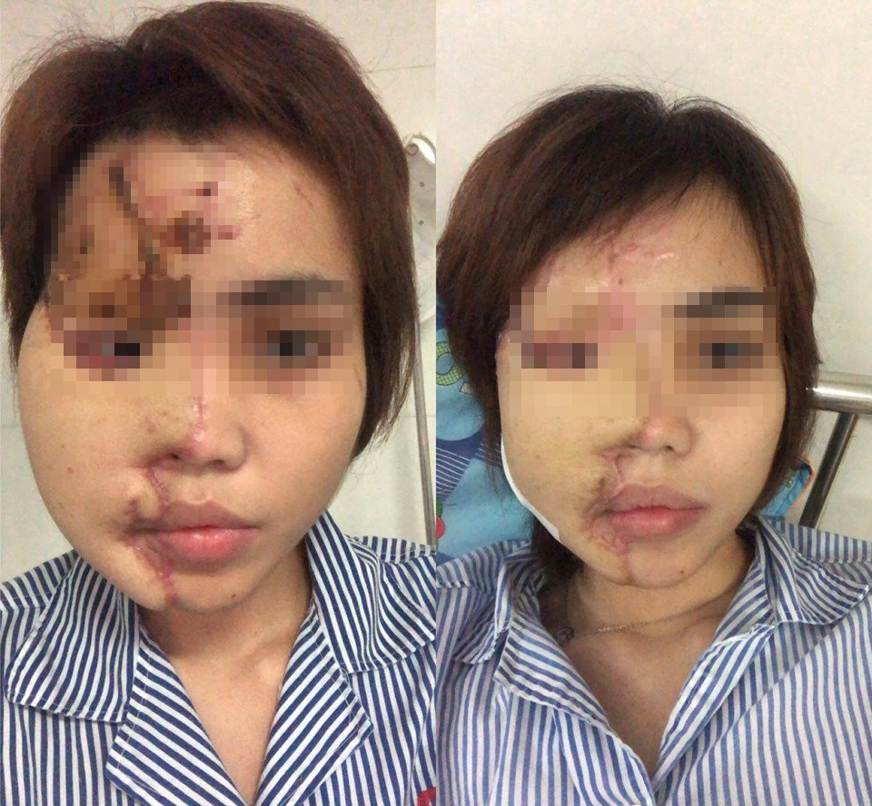 anh-tat-a-xit-dn-3-1716173 5