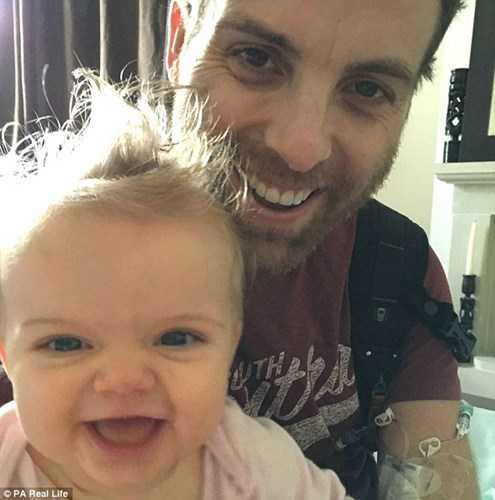 ong-bo-bi-vo-ruot-thua-khien-ung-thu-lay-khap-co-the-hinh-2