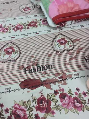 Mẹ hốt hoảng thấy con bị chuột cắn nát tay khi đang ngủ - ảnh 1