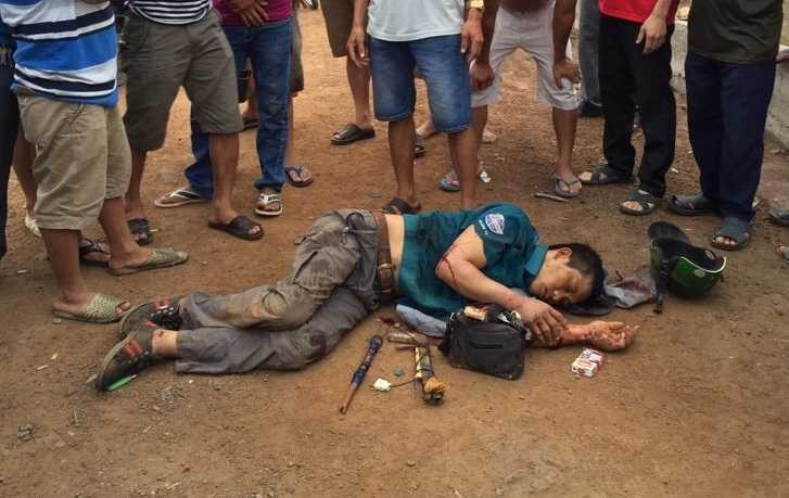 Trộm chó bị người dân bắt được với bộ đồ nghề bắt chó mang trên người /// Ảnh: Lê Lâm