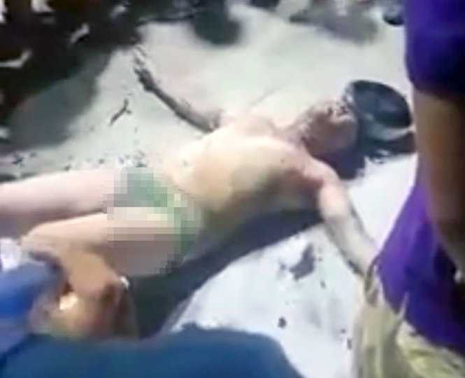 Chú thích ảnh: Nam thanh niên bị bỏng nặng do lửa bén xăng bị rây ra trong lúc đổ xăng - Ảnh: A.L