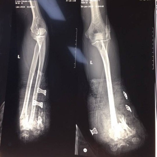 5161648619837097950120032027497199646015488n-15495518241132046997304