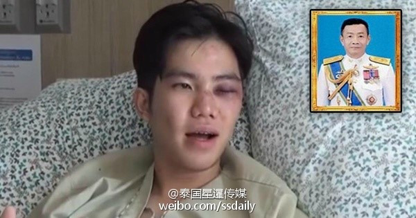 Nạn nhân bị hành hung là con trai thiếu tướng quân đội. Anh vẫn chưa mở được mắt sau hơn 1 tuần nằm viện. Ảnh: Sina.