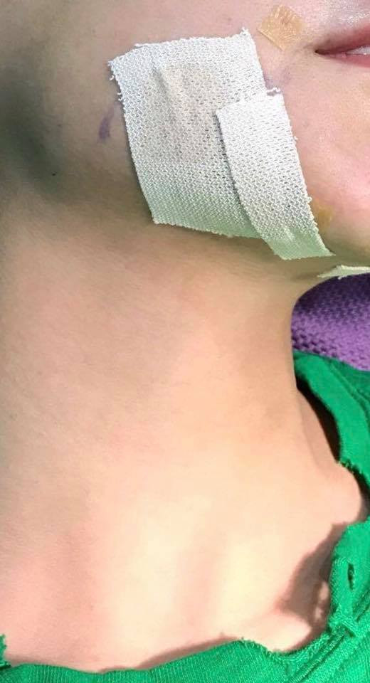 Hinh anh Tra Ngoc Hang lan dau len tieng truoc nghi van phau thuat tham my 4