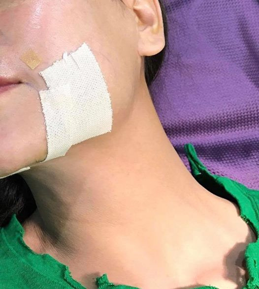 Hinh anh Tra Ngoc Hang lan dau len tieng truoc nghi van phau thuat tham my 5