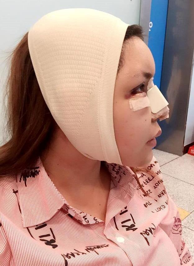 Hoc tro Dam Vinh Hung cong khai viec phau thuat toan bo co the hinh anh 1