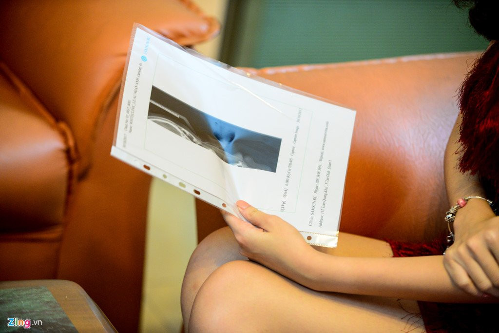 Nhan sac gay tranh cai cua Tan Hoa hau Dai duong giua doi thuong hinh anh 7