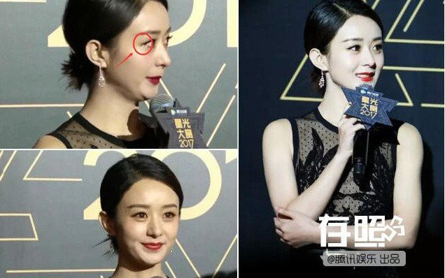 Sao nu Trung Quoc co ro, ngat xiu vi mac ho tren tham do: Loi tai ai? hinh anh 4