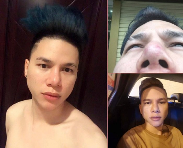 sao viet phau thuat tham my (3) 7