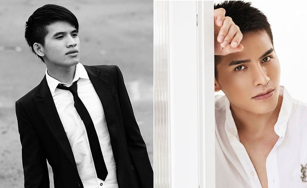 sao nam phau thuat tham my (3) 3