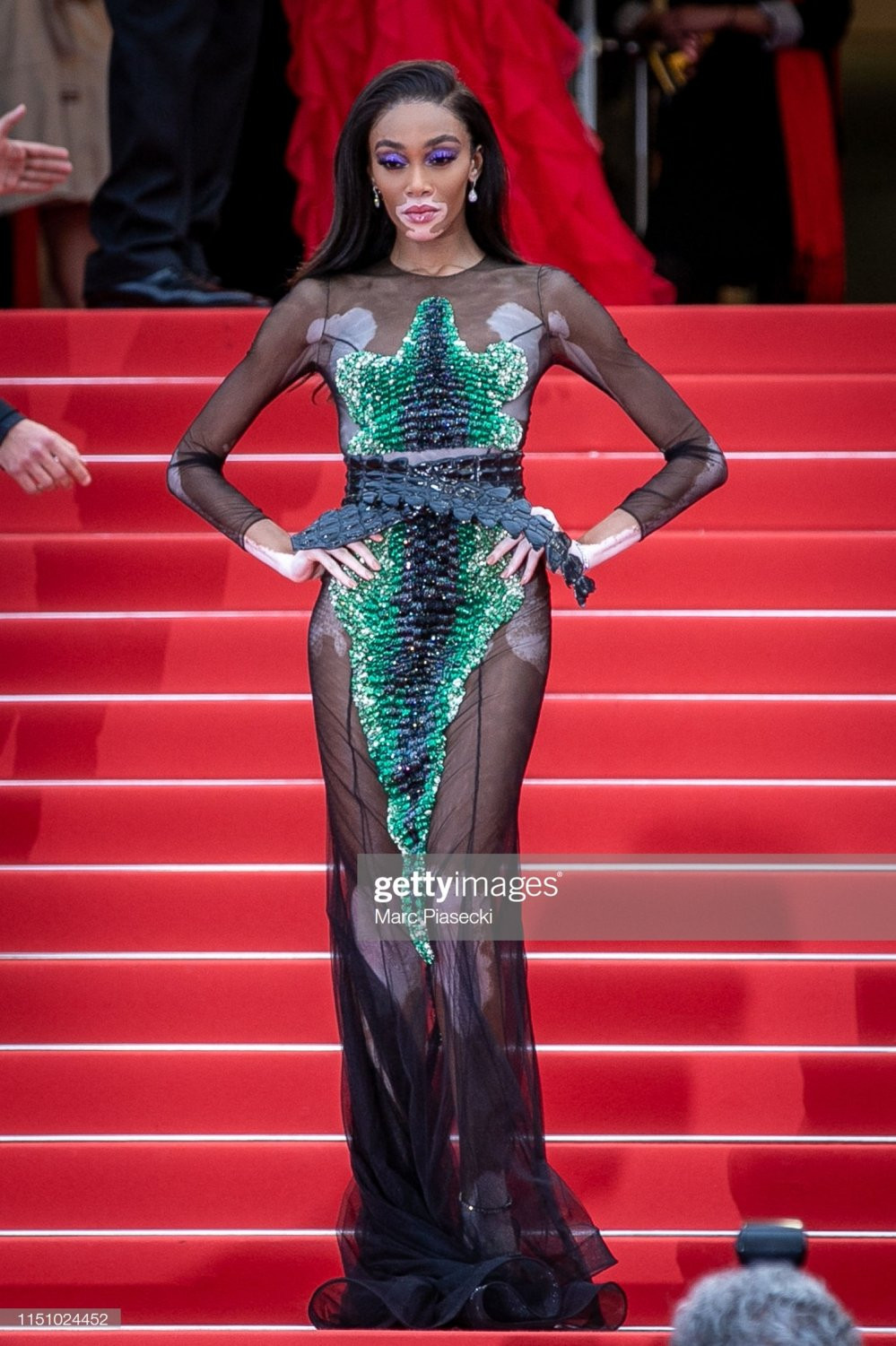 Next top Winnie Harlow (1) 9