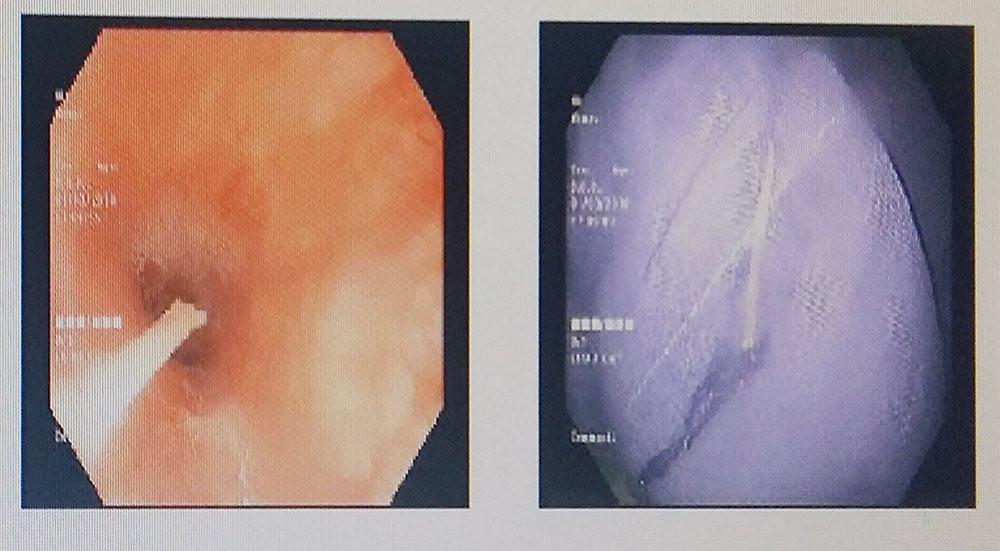 be-trai-15-thang-tuoi-hoc-xuong-ca-1