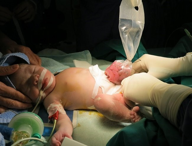 sinh-con-thuan-tu-nhien-hanh-dong-ngu-xuan