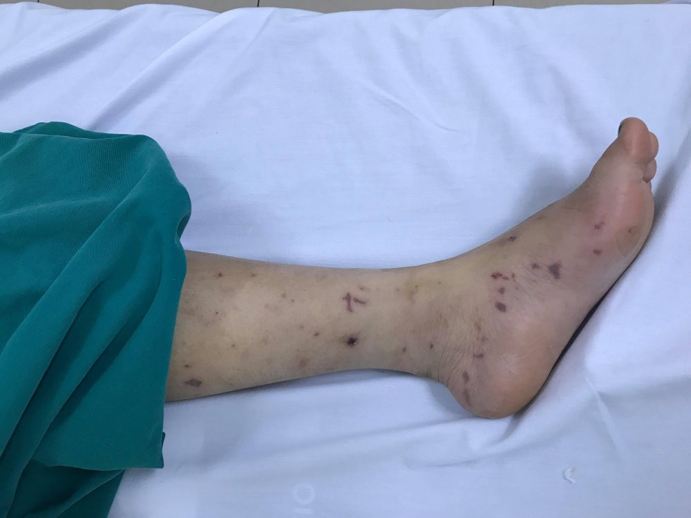 30704089_798796783642479_7887565743837937664_n