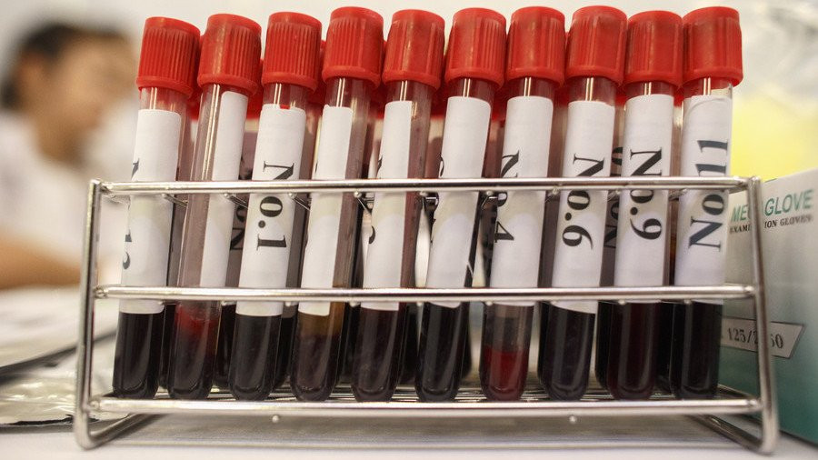 sap-co-vac-xin-tiem-phong-HIV-trong-tuong-lai