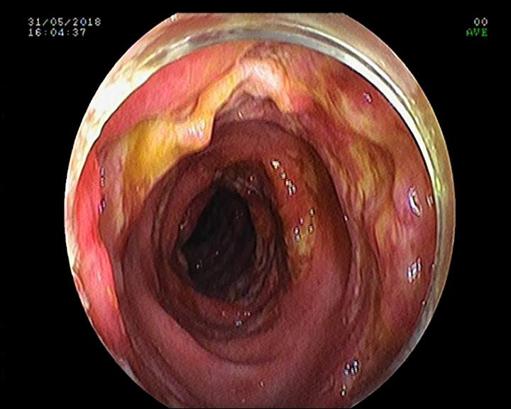 34072577_1771598442899880_2482275558449217536_n