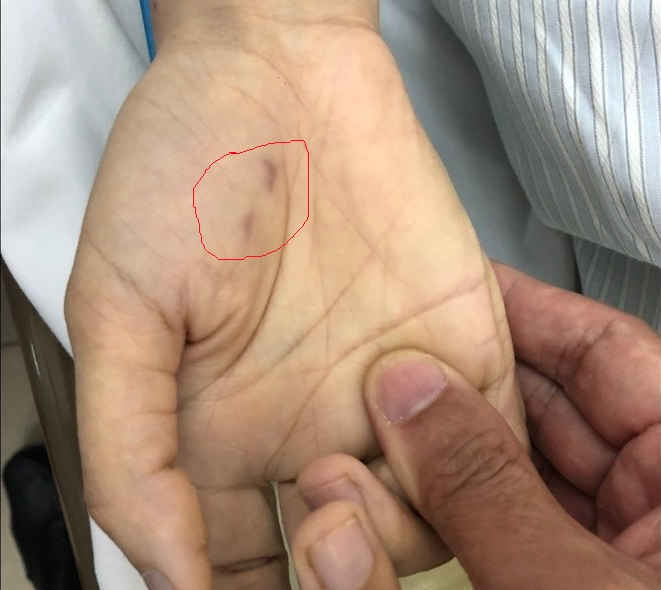 screenshot-bachmai.gov.vn-2018-06-05-07-17-16