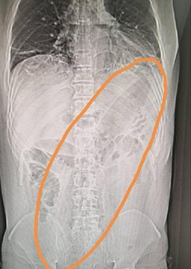 sei_15450385-e1528200513203