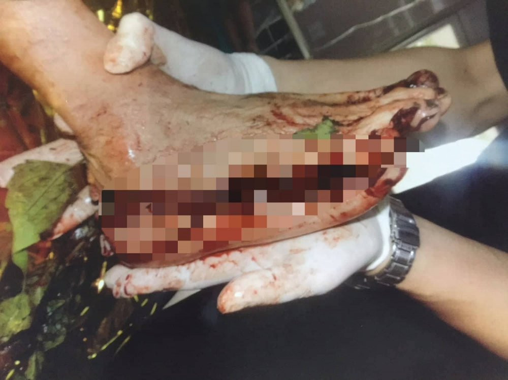 34779079_2014393358634017_5137403205302353920_n