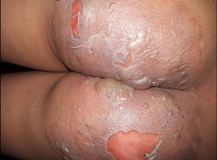 ha-noi-hang-xom-hat-noi-nuoc-vao-chau-nho