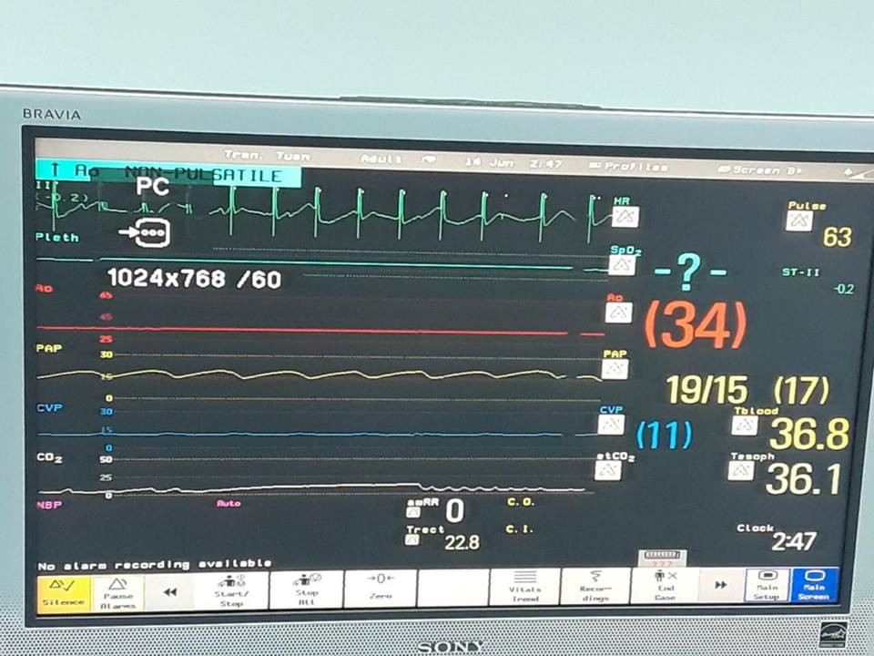 35148118_243429183097607_9166515753711566848_n