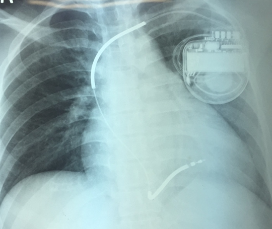 k-huu-icd-1501754884085