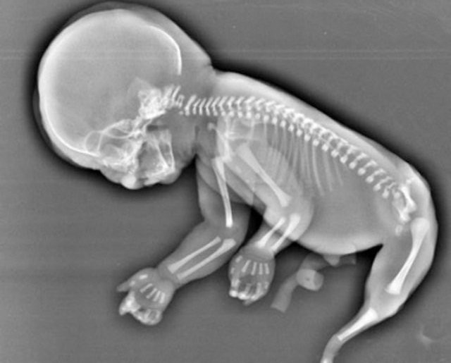 nang-tien-ca-178-1047