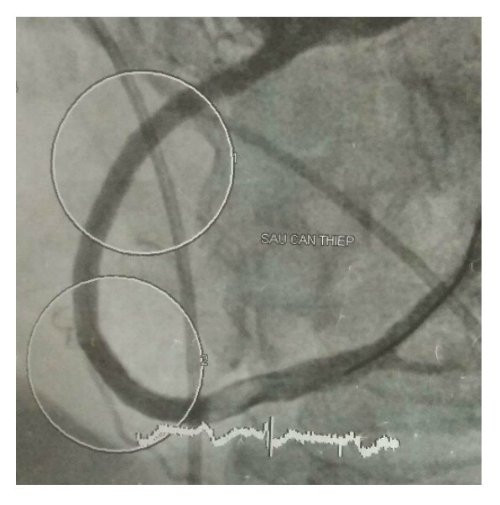 tac-mach-vanh-4471-1503157191