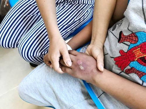 cha-me-ngheo-ngam-ngui-nhin-con-mat-dan-tri-nho-vi-ung-thu-mau-1