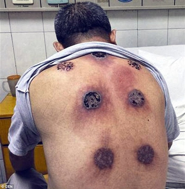 3593C4C200000578-3655854-Doctors_say_that_he_was_lucky_he_went_to_the_hospital_when_he_di-m-3_1466672313716 6